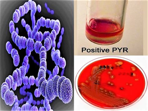 streptococcus pyogenes biochemical test|Various Biochemical Tests for Streptococcus pyogenes.